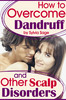 Thumbnail How To Overcome Dandruff Thumbnail How To Overcome Dandruff