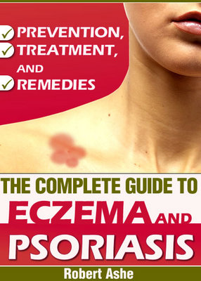 Product picture The Complete Guide to Eczema and Psoriasis